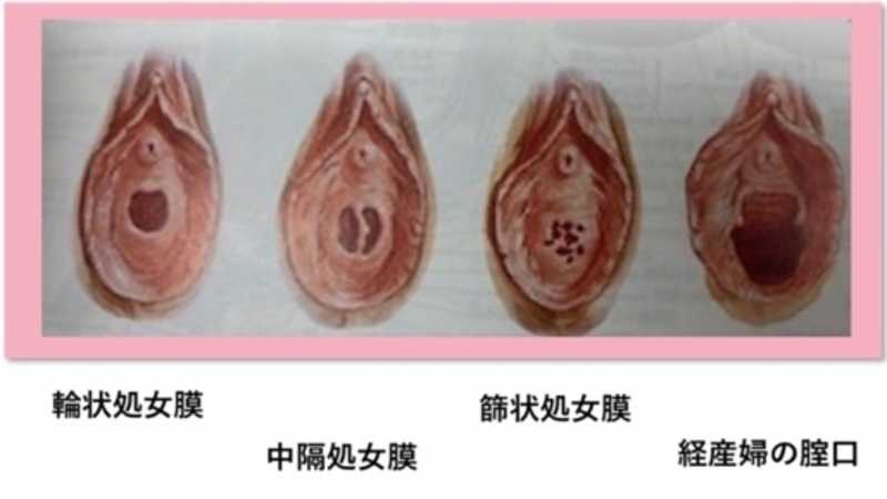 独占販売『処女喪失』、正真正銘の本物の処女喪失！！１８才、３ヶ月前まで高*●*生！！学費の支払いに困って、地方からわざわざ撮影に来ました！！処女喪失で人生初めての中出し、完全初撮影！！『個人撮影』個撮オリジナ